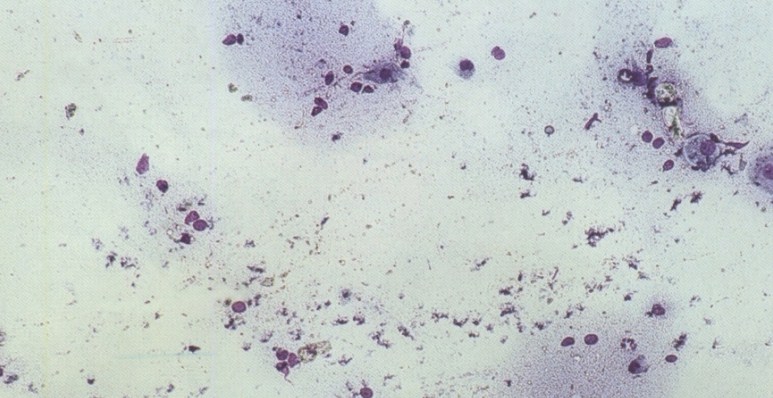 anoestrus